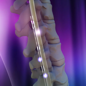 spinal device